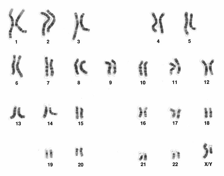 Chromosomenpaare Mensch
